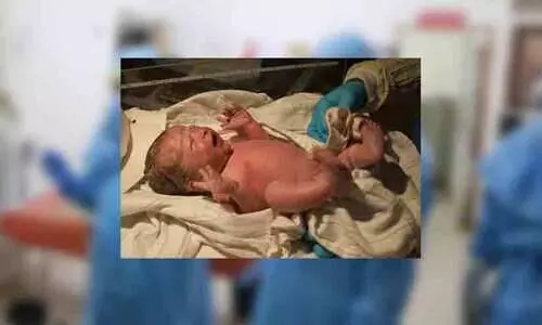 Health department staff arrived to care for the young woman who gave birth at home