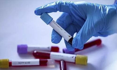 പോസ്​റ്റ്​ കോവിഡ്​ സിൻഡ്രോം: രോഗബാധിതരുടെ എണ്ണത്തിൽ വൻ വർധന