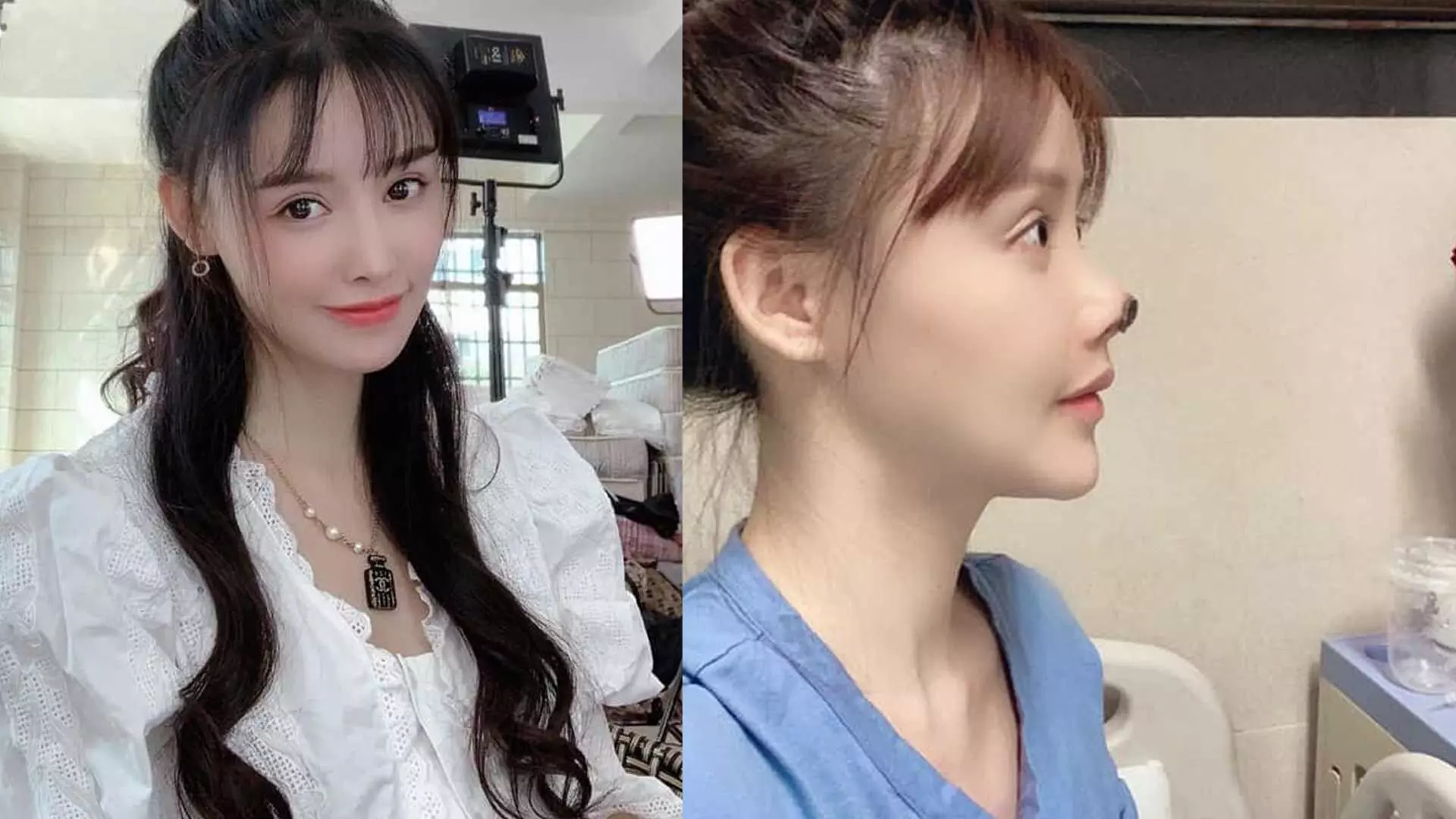 ഇനിയാരും സൗന്ദര്യവർധക ശസ്ത്രക്രിയ ചെയ്യല്ലേ...! ഞെട്ടിക്കുന്ന ചിത്രങ്ങൾ പങ്കുവെച്ച്​ നടി