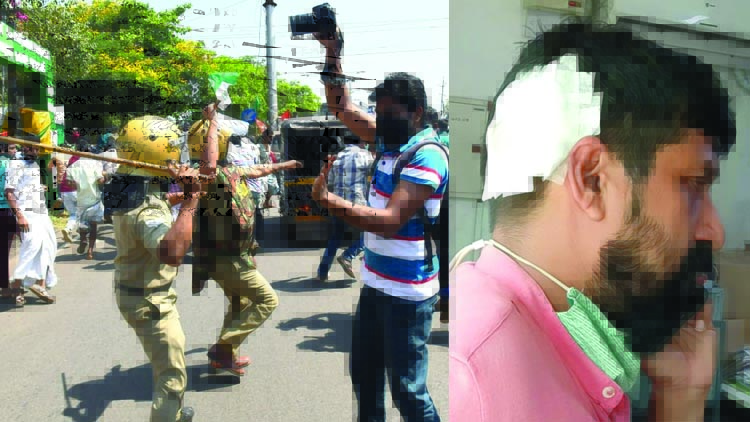 മലപ്പുറത്ത് മാധ്യമപ്രവര്‍ത്തകനെ പൊലീസ് ലാത്തികൊണ്ട് തലക്കടിച്ച് പരിക്കേല്‍പ്പിച്ചു