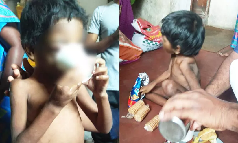 പൂട്ടിയിട്ട കുട്ടികളെ രക്ഷപ്പെടുത്തി; ദേഹം മുഴുവൻ അടിയേറ്റ പാടുകൾ, രക്ഷിതാക്കൾ കസ്റ്റഡിയിൽ പൂട്ടിയിട്ട കുട്ടികളെ രക്ഷപ്പെടുത്തി; ദേഹം മുഴുവൻ അടിയേറ്റ പാടുകൾ, രക്ഷിതാക്കൾ കസ്റ്റഡിയിൽ