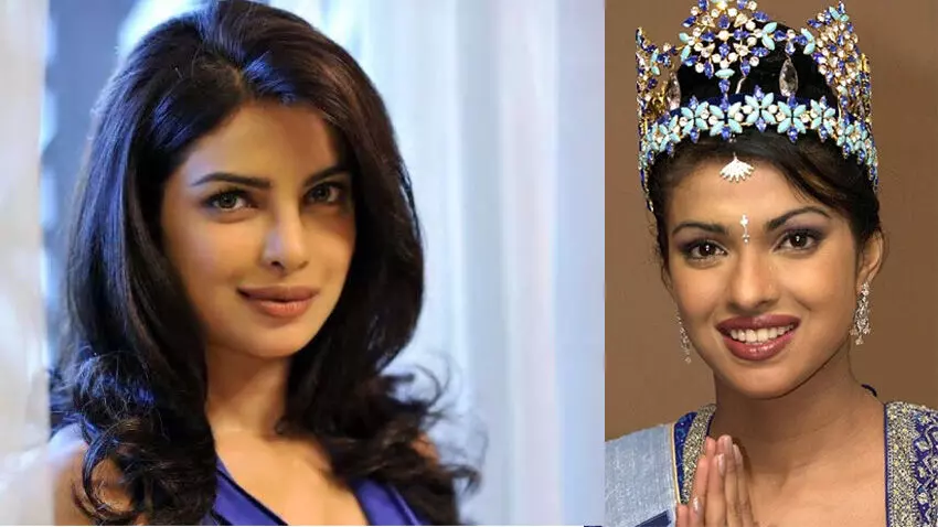 എനിക്ക് യഥാർഥ രൂപം നഷ്ടമായി, ഞാൻ ഞാനല്ലാതായി മാറി; മൂക്കിന് നടത്തിയ ശസ്ത്രക്രിയ പാളിയ അനുഭവം പങ്കുവെച്ച് പ്രിയങ്ക ചോപ്ര എനിക്ക് യഥാർഥ രൂപം നഷ്ടമായി, ഞാൻ ഞാനല്ലാതായി മാറി; മൂക്കിന് നടത്തിയ ശസ്ത്രക്രിയ പാളിയ അനുഭവം പങ്കുവെച്ച് പ്രിയങ്ക ചോപ്ര