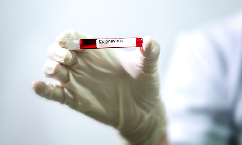 ഇന്ന് 4505 പേര്‍ക്ക് കോവിഡ്;  15 മരണം