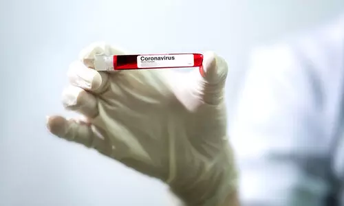 കോവിഡ്: ഖത്തറിൽ സാമൂഹിക അകലം പാലിക്കാത്തവർക്കെതിരെയും നടപടി കോവിഡ്: ഖത്തറിൽ സാമൂഹിക അകലം പാലിക്കാത്തവർക്കെതിരെയും നടപടി