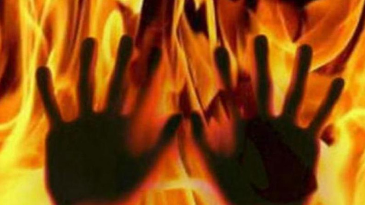 ശവസംസ്കാരത്തിനിടെ തീ പടർന്ന് അഞ്ചുപേര്ക്ക് പൊള്ളലേറ്റു ശവസംസ്കാരത്തിനിടെ തീ പടർന്ന് അഞ്ചുപേര്ക്ക് പൊള്ളലേറ്റു