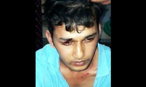 തട്ടിയെടുത്ത കാറുമായി യുവാവ്​ പാഞ്ഞു; അപകടത്തി​െനാടുവിൽ പിടിവീണ​ു