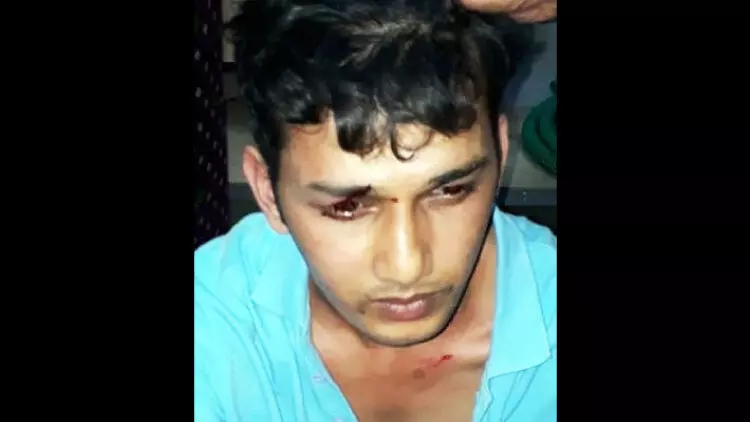 തട്ടിയെടുത്ത കാറുമായി യുവാവ്​ പാഞ്ഞു; അപകടത്തി​െനാടുവിൽ പിടിവീണ​ു