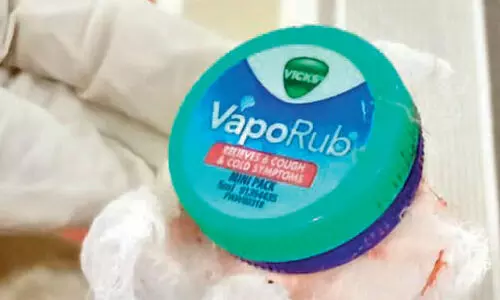 കു​ഞ്ഞി​െൻറ തൊ​ണ്ട​യി​ൽ ഡ​പ്പി കു​രു​ങ്ങി​; എ​ൻ​ഡോ​സ്കോ​പ്പി വ​ഴി പു​റ​ത്തെ​ടു​ത്തു