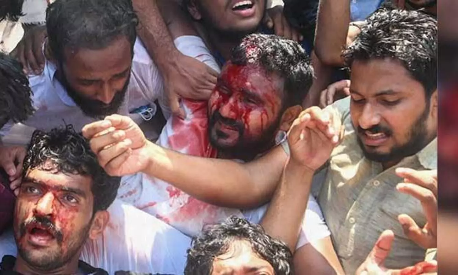 കെ.എസ്​.യു സെക്ര​േട്ടറിയേറ്റ്​ മാർച്ചിൽ സംഘർഷം; പൊലീസ്​ ലാത്തിവീശി, നിരവധി പ്രവർത്തകർക്ക്​ പരിക്ക്​