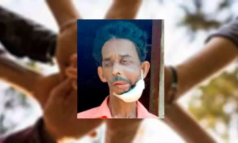 thulaseedharan pillai, who is suffering from cancer, seeks medical help