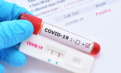 പ്ര​വാ​സി​ക​ൾ​ക്ക്​ ആ​ർ.​ടി.​പി.​സി.​ആ​ർ ടെ​സ്​​റ്റ്​