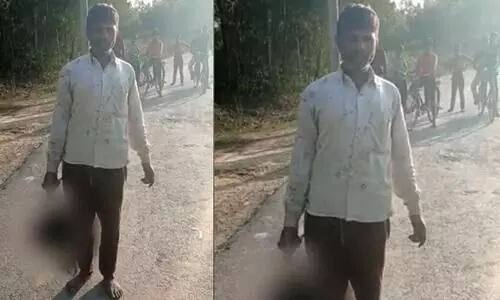 Man walking down the road with the severed head of his daughter