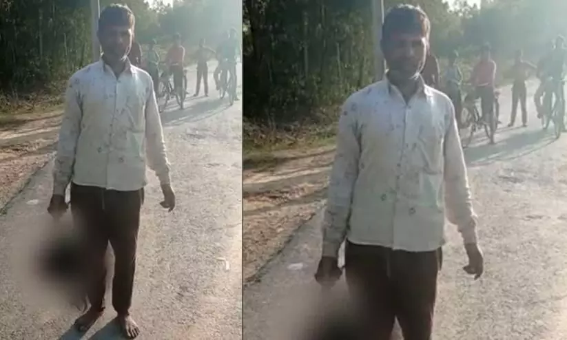 Man walking down the road with the severed head of his daughter