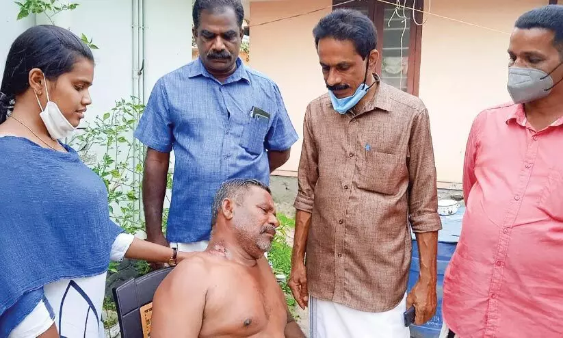 മത്സ്യത്തൊഴിലാളിക്ക് സൂര്യാതപമേറ്റു മത്സ്യത്തൊഴിലാളിക്ക് സൂര്യാതപമേറ്റു