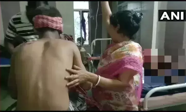 ബംഗാളിൽ പെട്രോൾ ബോംബേറിൽ ആറ്​ ബി.ജെ.പി പ്രവർത്തകർക്ക്​ പരിക്ക്​; രണ്ട്​ പേരുടെ നില ഗുരുതരം