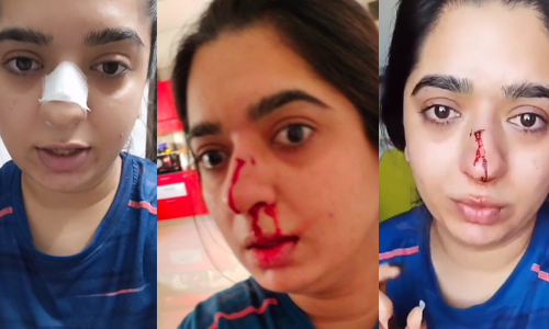 സൊമാറ്റോയിൽ ഭക്ഷണം കിട്ടാൻ വൈകിയതിന്​ തർക്കം; ​ഡെലിവറി ബോയി മൂക്കിന്​ ഇടിച്ചതായി യുവതിയുടെ പരാതി