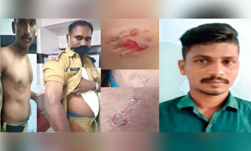 policemen-injured-in-youths-attack