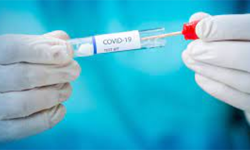 സ്വകാര്യ ആശുപത്രികളില്‍ കോവിഡ്​ ടെസ്​റ്റിന്​ 300 റിയാൽ മതി