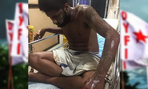 ഡി.വൈ.എഫ്‌.ഐ നേതാവിന്​ നേരെ ആസിഡ്​ ആക്രമണം