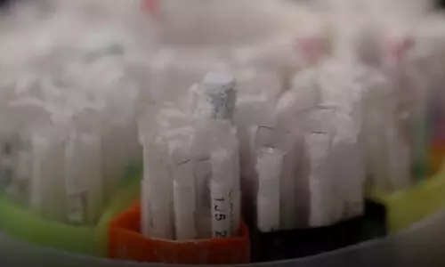 കോവിഡ്​ മഹാമാരി വില്ലനായി; ബീജ ദൗർലഭ്യത്തിൽ വലഞ്ഞ്​ സ്വീഡൻ