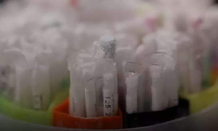 കോവിഡ്​ മഹാമാരി വില്ലനായി; ബീജ ദൗർലഭ്യത്തിൽ വലഞ്ഞ്​ സ്വീഡൻ