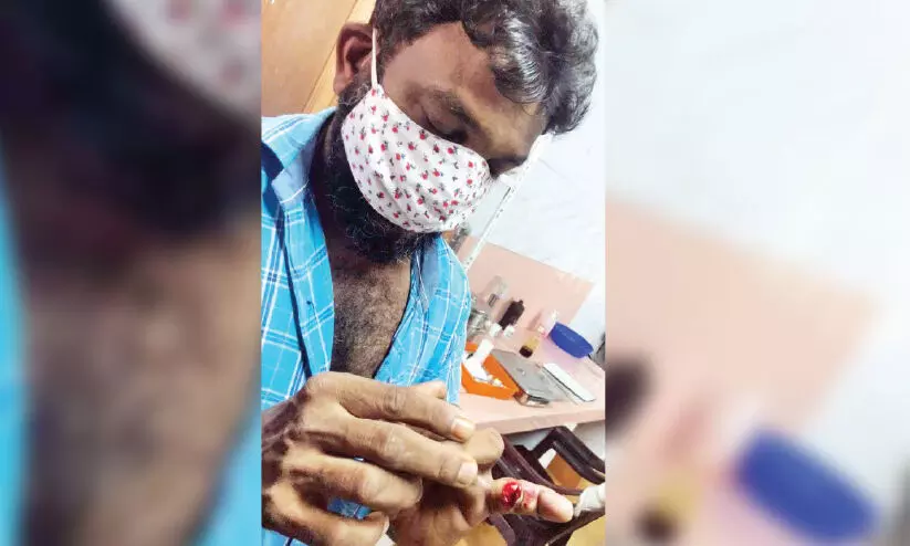 കുഞ്ഞാലിപ്പാറ സമര സമിതി പ്രവര്‍ത്തക​െൻറ കൈവിരല്‍ ലോറി ഡ്രൈവര്‍ തല്ലിയൊടിച്ചു