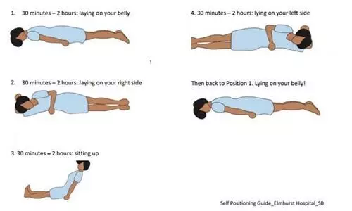 കോവിഡ്​ ബാധിച്ച് വീട്ടിൽ കഴിയുന്നവർ​ കമിഴ്​ന്ന്​ കിടക്കണം എന്ന് ആരോഗ്യ മന്ത്രാലയം; കാര്യമിതാണ്​