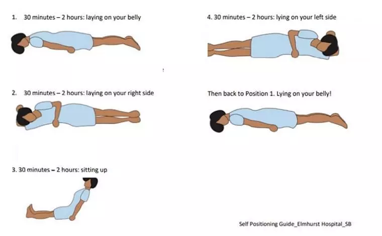കോവിഡ്​ ബാധിച്ച് വീട്ടിൽ കഴിയുന്നവർ​ കമിഴ്​ന്ന്​ കിടക്കണം എന്ന് ആരോഗ്യ മന്ത്രാലയം; കാര്യമിതാണ്​