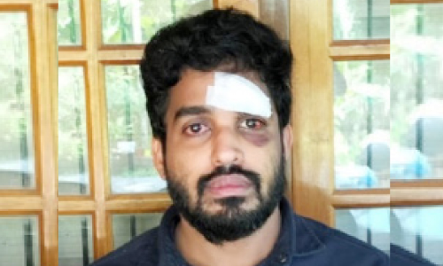 വാ​ട​ക​ക്ക്​ ന​ൽ​കി​യ കാ​റും തി​രി​ച്ചു​വാ​ങ്ങാ​ൻ ചെ​ന്ന ആ​ളു​ക​ൾ സ​ഞ്ച​രി​ച്ച കാ​റും ത​ട്ടി​യെ​ടു​ത്ത പ​രാ​തി​യി​ൽ തു​മ്പാ​യി​ല്ല