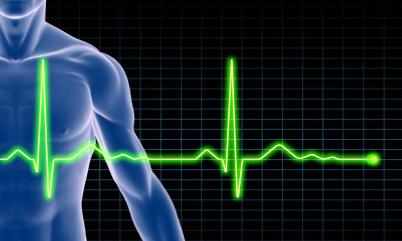 ecg ecg