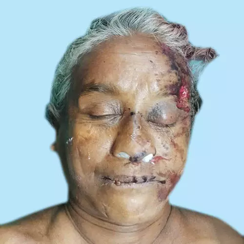 അ​ജ്ഞാ​ത സ്ത്രീ ​ബ​സ് ത​ട്ടി മ​രി​ച്ചു