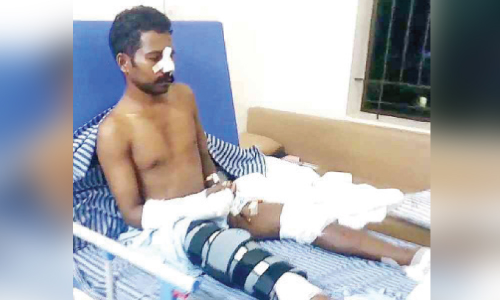 മനോജിന്​ വേണം സുമനസുകളുടെ കൈത്താങ്ങ്​; ചികിത്സാസഹായ നിധി രൂപവത്​കരിച്ചു