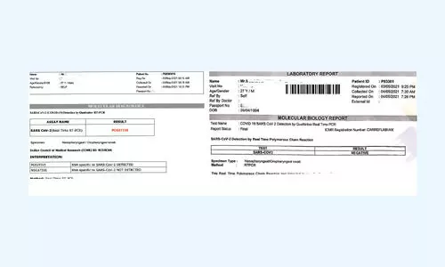 ഒരേദിവസം രണ്ടു കോവിഡ്​ ടെസ്​റ്റ്​; ലഭിച്ചത്​   വ്യത്യസ്​ത ഫലം!