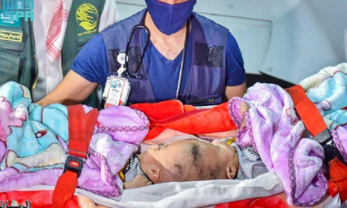 യ​മ​നി സ​യാ​മീ​സ്​ ഇ​ര​ട്ട​ക​ൾ യൂ​സു​ഫി​നെ​യും യാ​സീ​നെ​യും റി​യാ​ദി​ലെ​ത്തി​ച്ചു