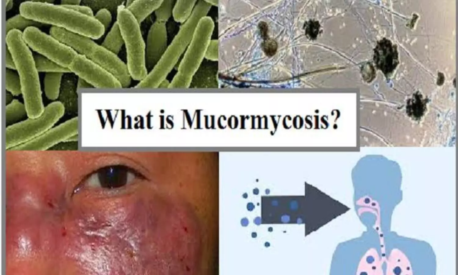 infoclinicindia Health & Wellness Website covid