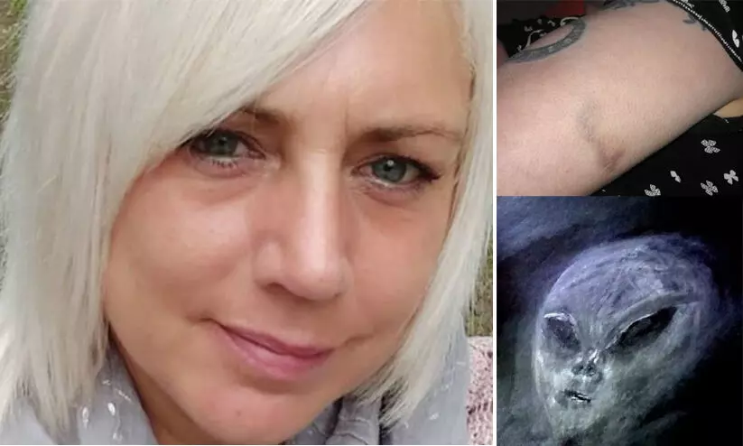 അന്യഗ്രഹജീവികൾ പല തവണയായി തട്ടിക്കൊണ്ടുപോയി; വിചിത്രമായ തെളിവുകൾ നിരത്തി സ്ത്രീയുടെ അവകാശവാദം അന്യഗ്രഹജീവികൾ പല തവണയായി തട്ടിക്കൊണ്ടുപോയി; വിചിത്രമായ തെളിവുകൾ നിരത്തി സ്ത്രീയുടെ അവകാശവാദം