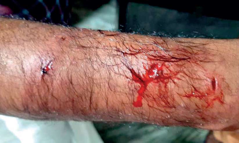 dog attack dog attack