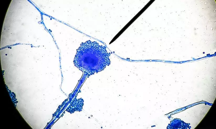 black fungus black fungus