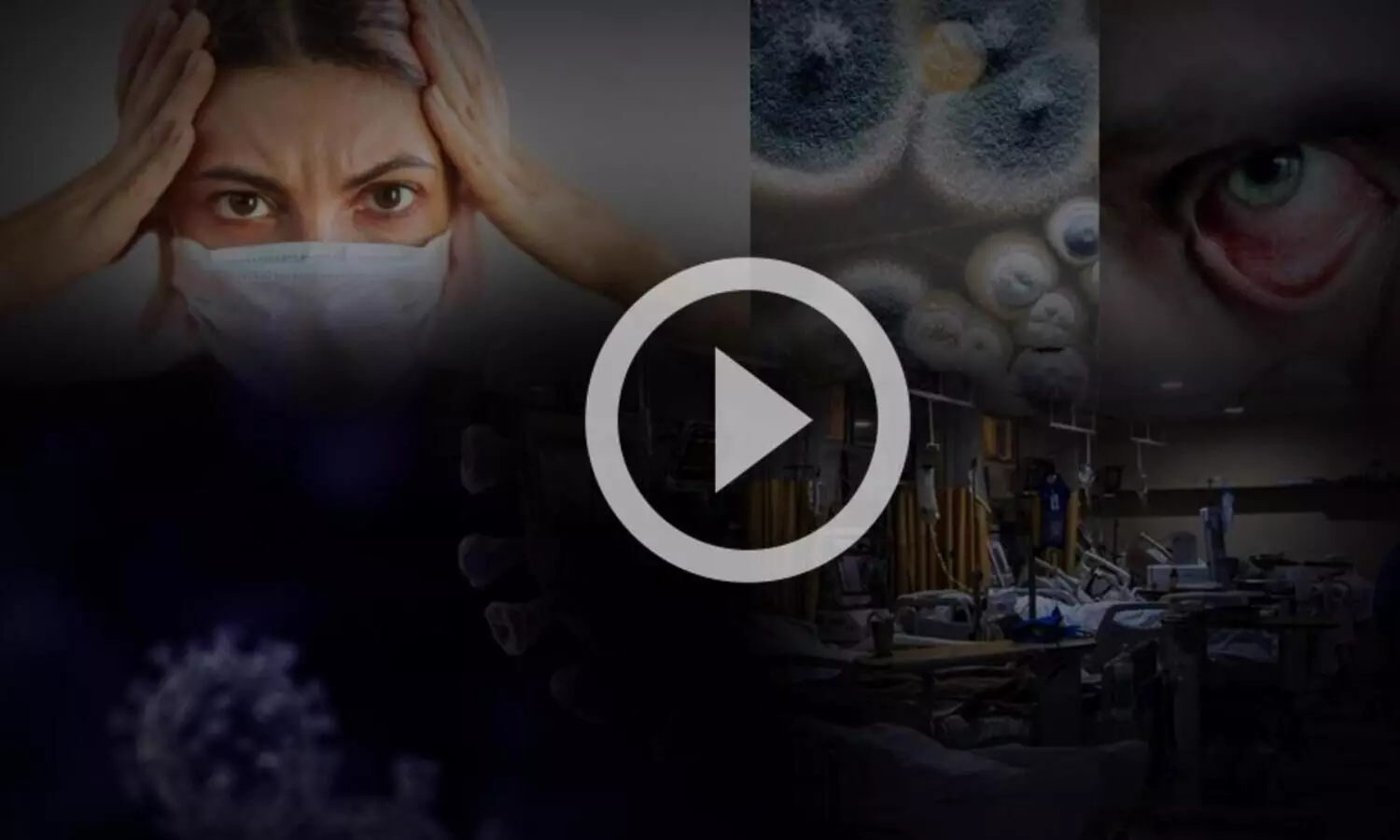 എന്താണ് ബ്ലാക് ഫം​ഗസ് ? അറിയേണ്ടതെല്ലാം....