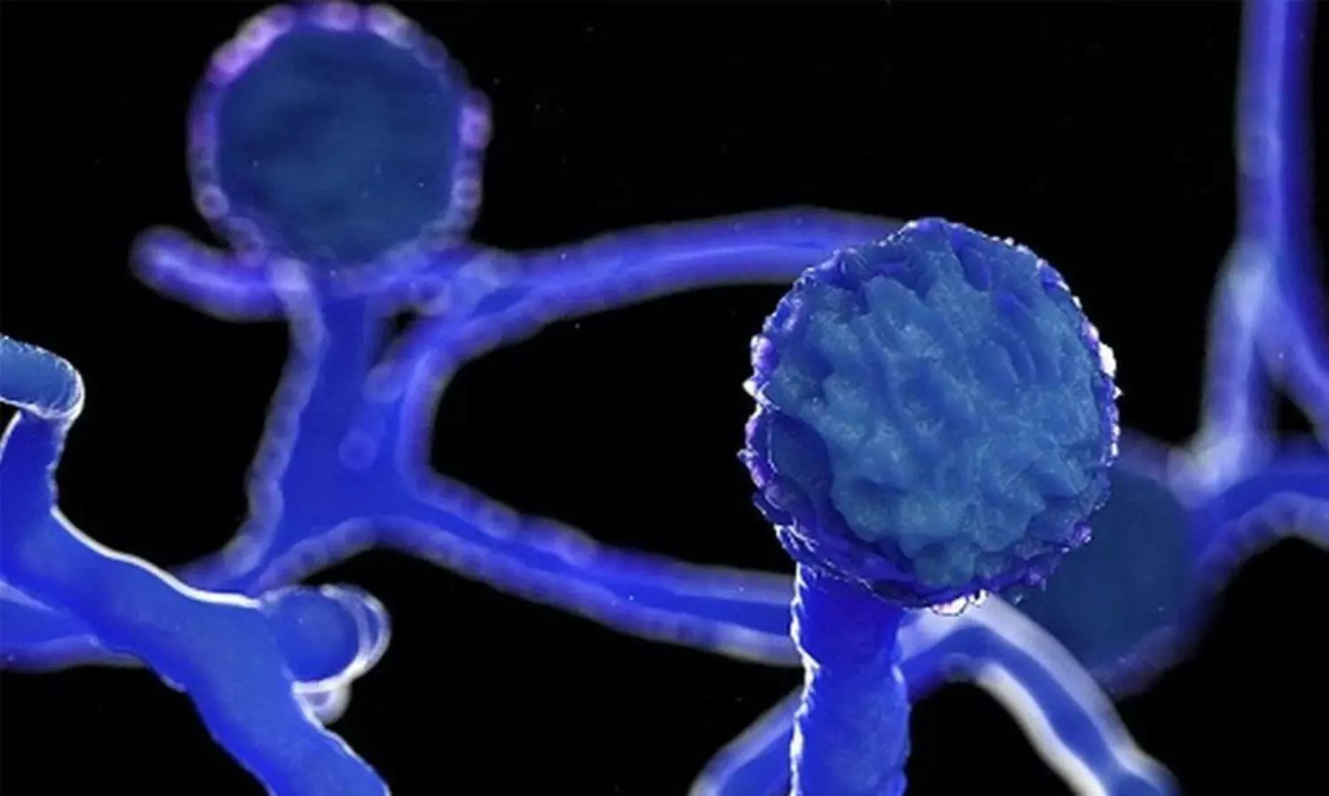 ബ്ലാക്ക്​ ഫംഗസ്​  പകരുന്ന രോഗമല്ല,​ ചികിത്സയും സഹായവും നല്‍കാന്‍ ഭയപ്പെടേണ്ട - മുഖ്യമന്ത്രി