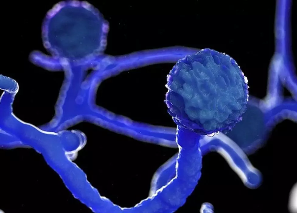 കോവിഡ്​ മുക്​തരിലെ മാറാ തലവേദനയും മുഖത്തെ തടിപ്പും ബ്ലാക്ക്​ ഫംഗസി​െൻറ അടയാളം- എയിംസ്​ മേധാവി