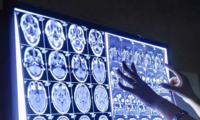 ബ്ലാക്​ ഫംഗസ്​ ബാധയിൽ കൂടുതൽ സംസ്​ഥാനങ്ങൾ