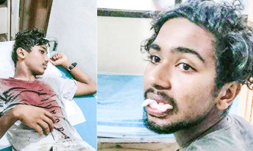 ലോക് ഡൗൺ വിലക്ക് ലംഘിച്ച് പുറത്തിറങ്ങിയവർക്ക് പൊലീസി​െൻറ ക്രൂര മർദനം