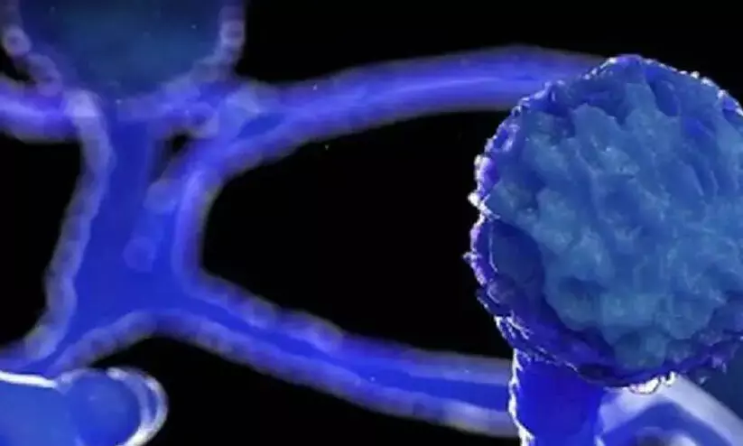 രാജ്യത്ത് 8,848 പേർക്ക് ബ്ലാക് ഫംഗസ്; ചികിത്സ സൗജന്യമാക്കണമെന്ന് സോണിയ രാജ്യത്ത് 8,848 പേർക്ക് ബ്ലാക് ഫംഗസ്; ചികിത്സ സൗജന്യമാക്കണമെന്ന് സോണിയ