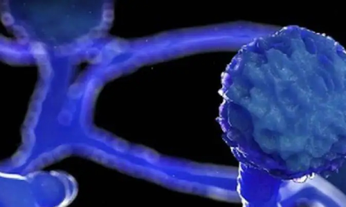 ബ്ലാക്ക് ഫംഗസ്: സംസ്​ഥാനത്ത്​ രണ്ട്​ മരണം