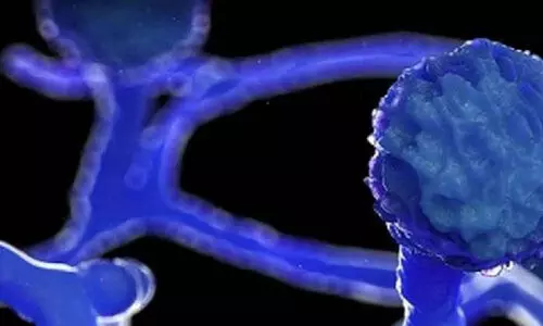 ബ്ലാക്ക് ഫംഗസ് സംശയം; രോഗിയെ പരിയാരം മെഡിക്കൽ കോളജിലേക്ക് മാറ്റി