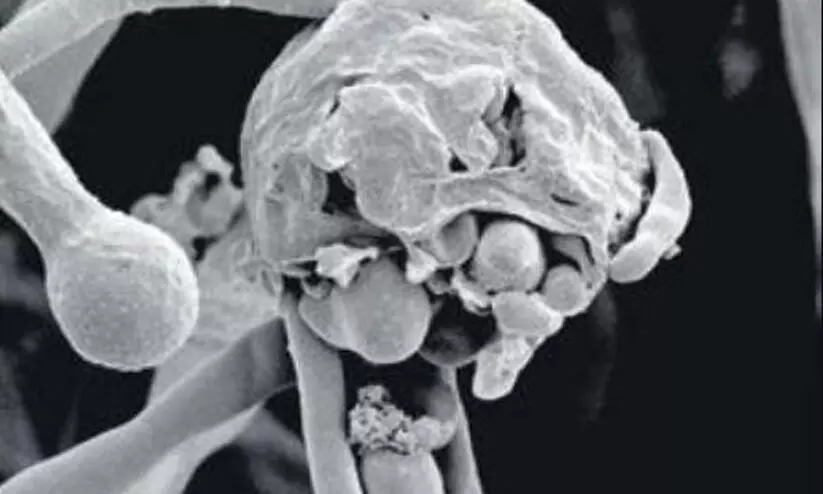 പുണെയിൽ ബ്ലാക്ക് ഫംഗസ് ബാധിച്ച് 25 മരണം; 574 പേർക്ക് രോഗം