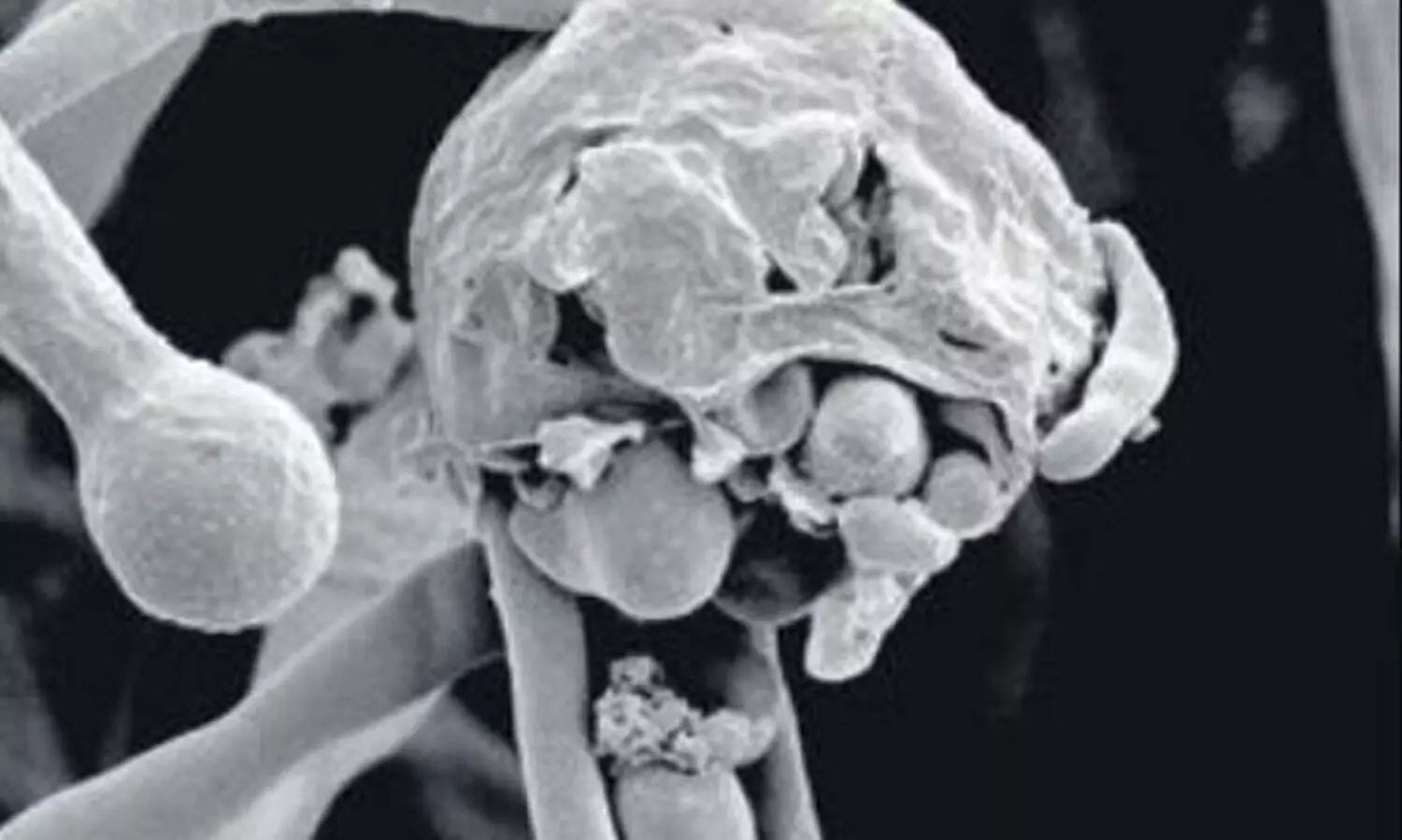 പുണെയിൽ ബ്ലാക്ക് ഫംഗസ് ബാധിച്ച് 25 മരണം; 574 പേർക്ക് രോഗം