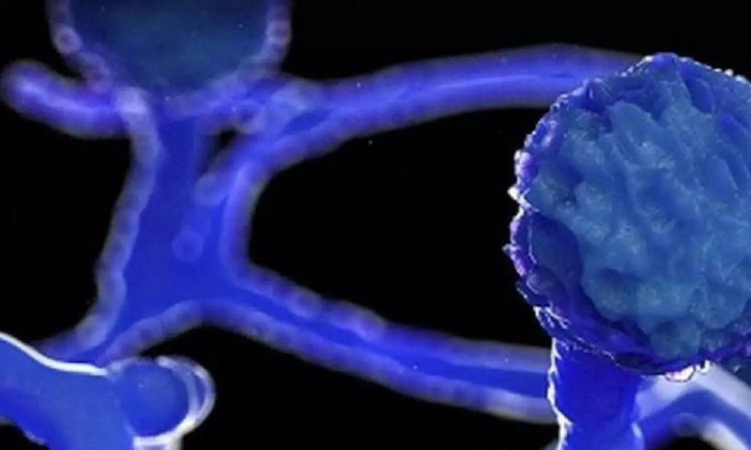 ബ്ലാക്ക് ​ഫംഗസ്​: മരുന്നെത്തി, പ്രതിസന്ധിക്ക്​ താൽക്കാലിക പരിഹാരം