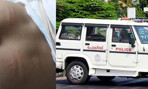 പൊലീസാണ് വൈറസ്;  മർദനമേറ്റ യുവാവിന്റെ കുറിപ്പ് വൈറൽ